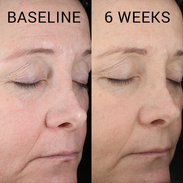 Dr Scheel Pure Hydration Hyaluronic Acid Serum image 2