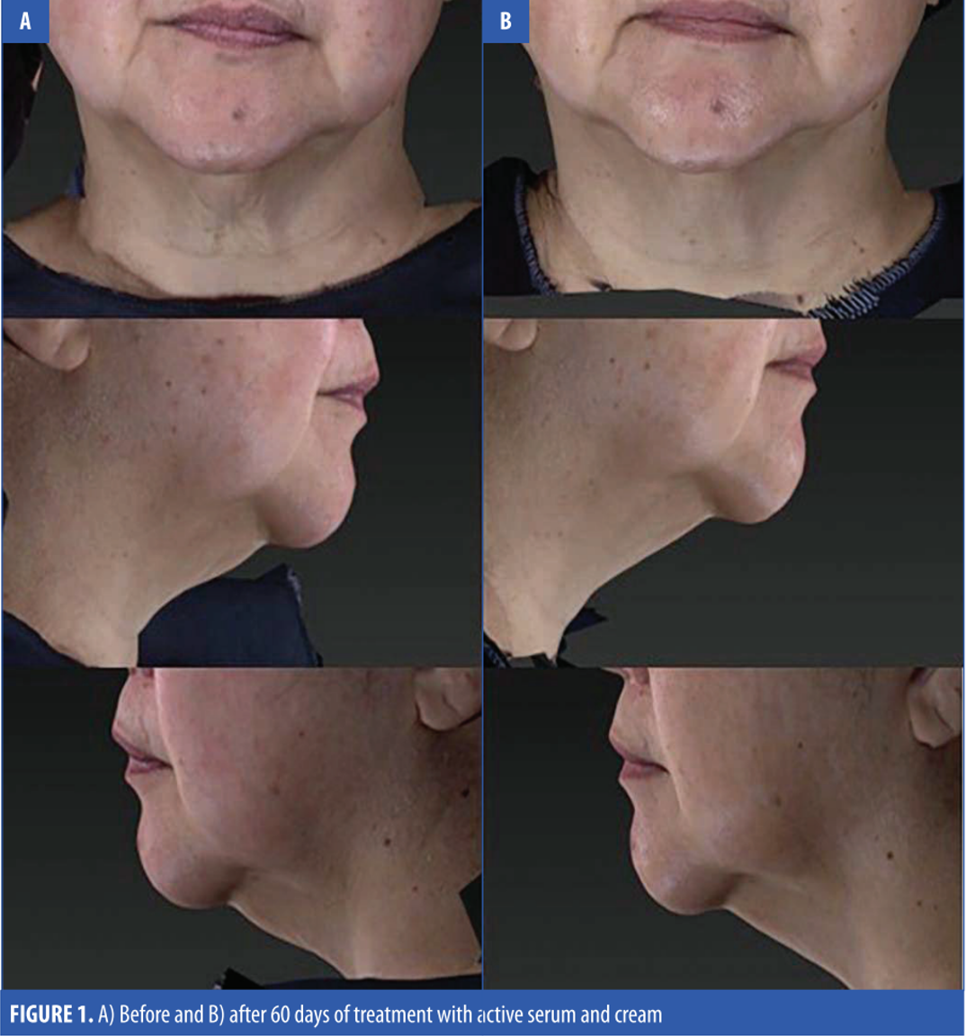 Dr Scheel Lift + Firm Neck Cream image 3