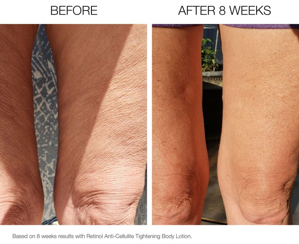 Dr Scheel Retinol Firming Body Crème image 1