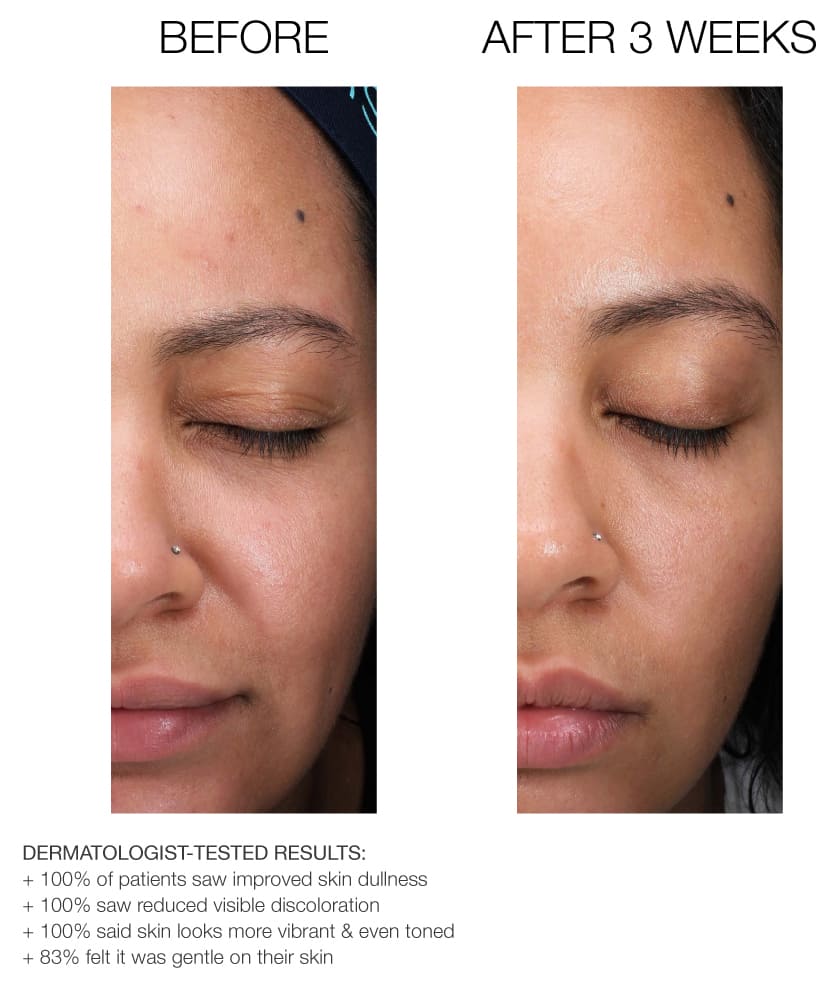 Dr Scheel Radiant Pink Renewal Serum image 2