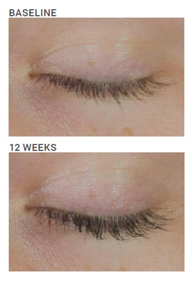 Dr Scheel PROLash Peptide Lash Enhancer image 1