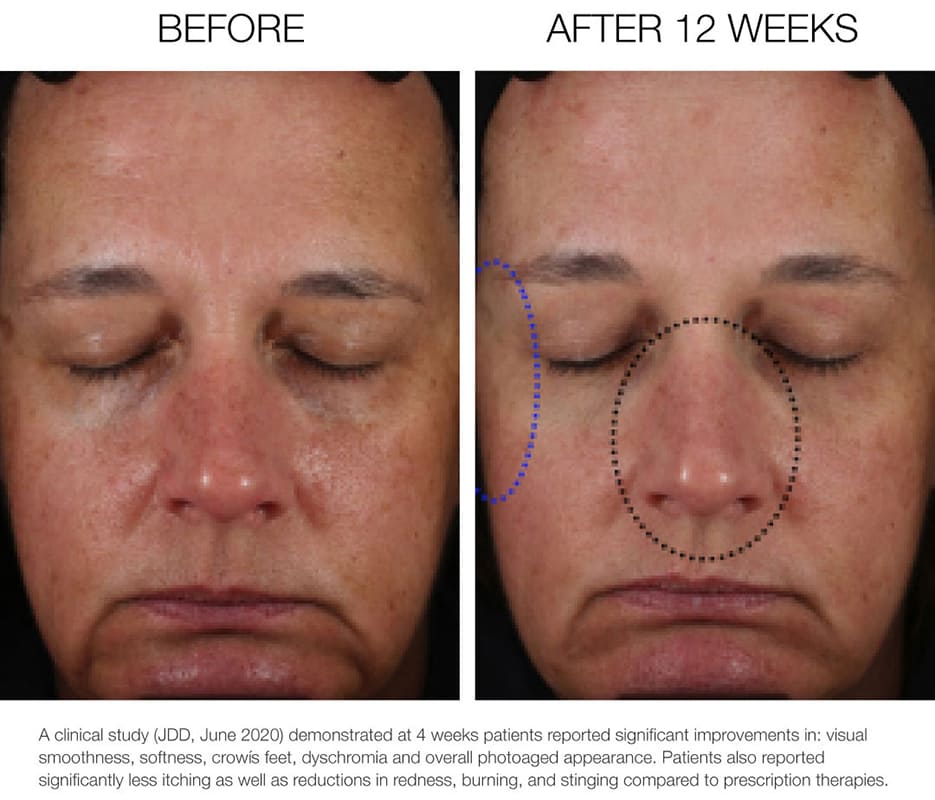 Dr Scheel Platinum Collagen Boosting Vit CE Green Tea Serum image 1