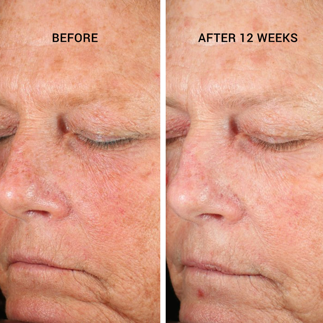 Dr Scheel Age Defying Retinol Serum image 4