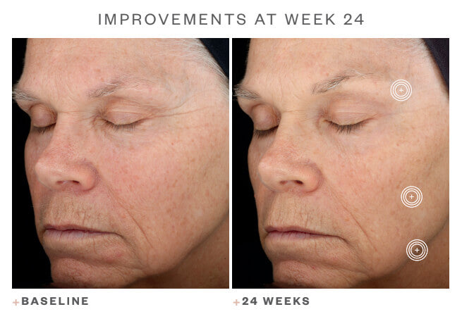SkinMedica TNS Advanced+Serum image 2