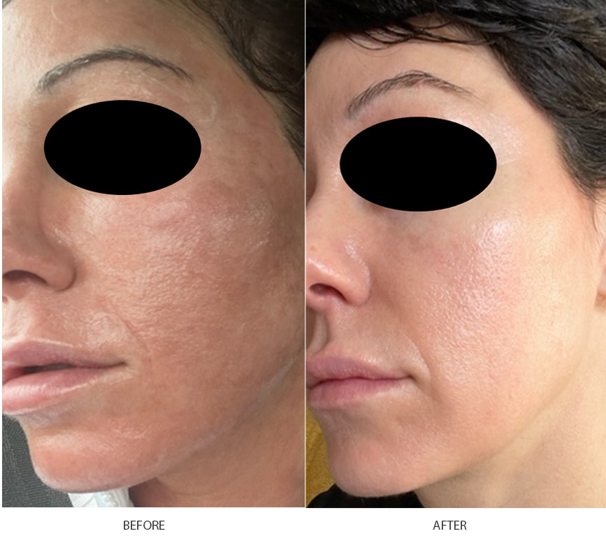 Phyto Correction Serum image 3