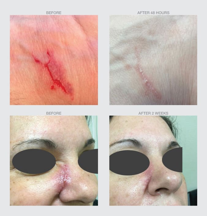 Dr Scheel Silicone Scar Repair Gel image 1