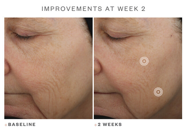 SkinMedica TNS Advanced+Serum image 1