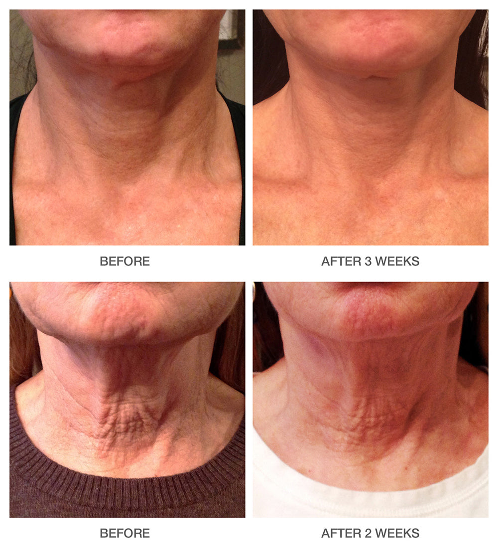 Dr Scheel Lift + Firm Neck Cream image 2